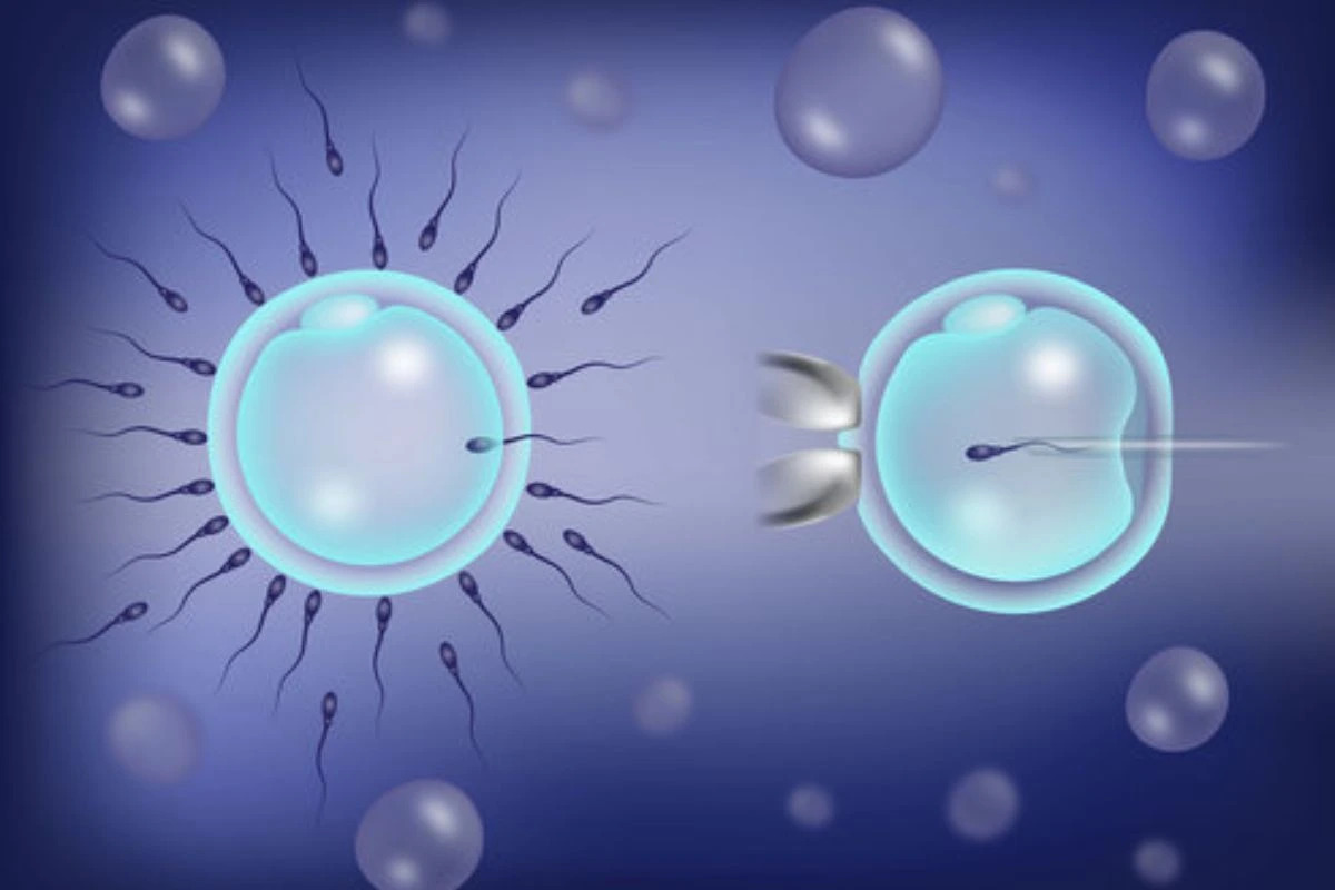 IVF and ICSI